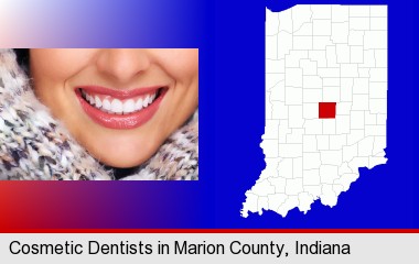 beautiful white teeth forming a beautiful smile; Marion County highlighted in red on a map